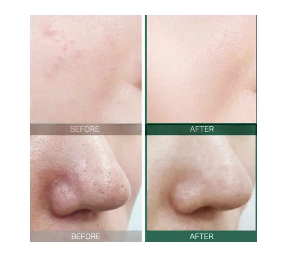 SOME BY MI AHA BHA PHA 30 Days Miracle Toner – 150ml