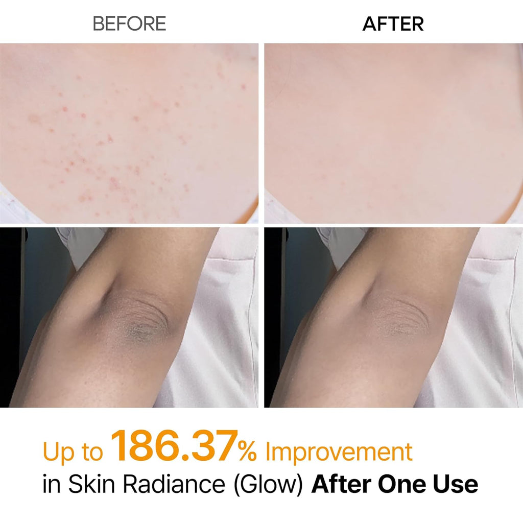 Dr. Melaxin Peel Shot Exfoliating Kojic Acid Turmeric Spray – 200 mL