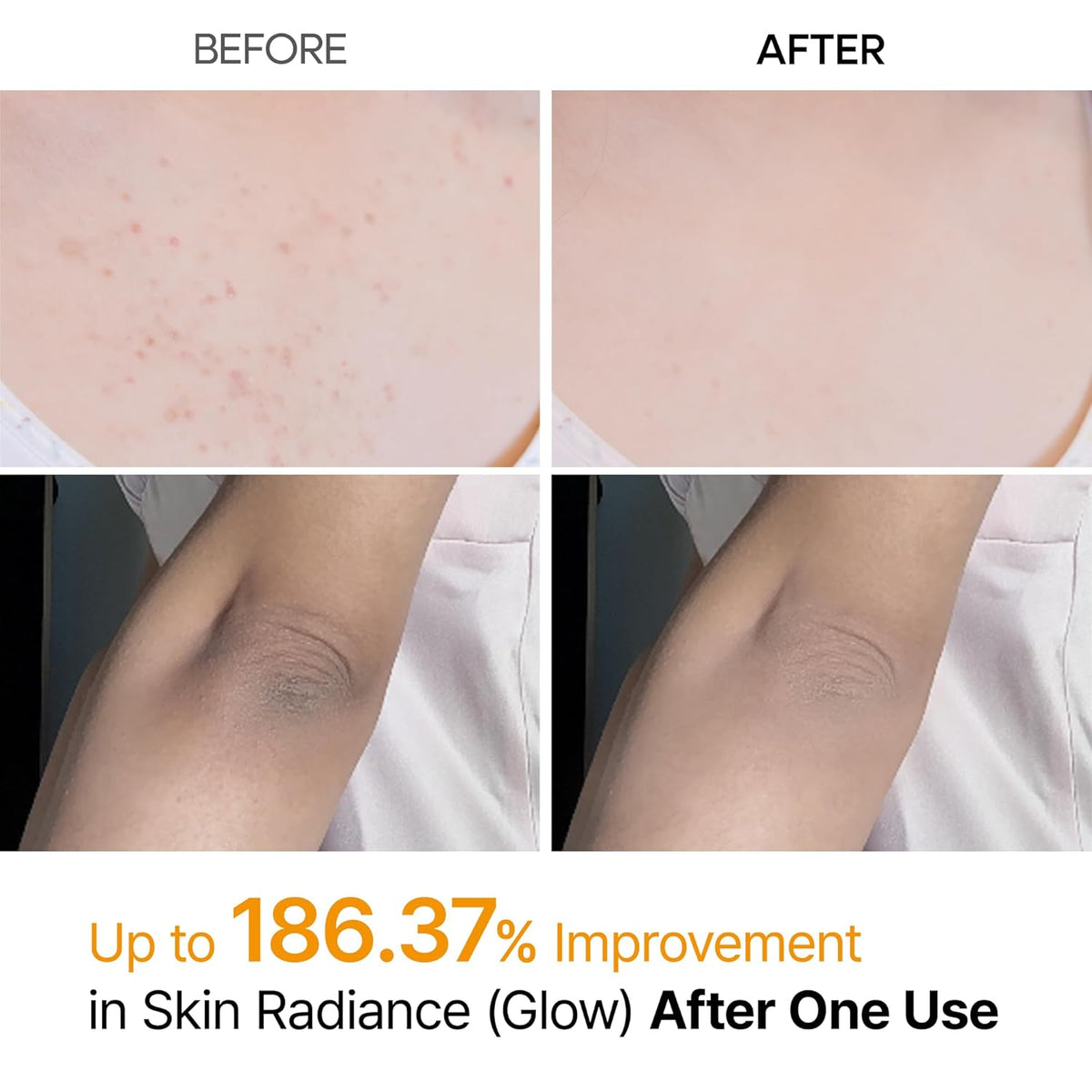 Dr. Melaxin Peel Shot Exfoliating Kojic Acid Turmeric Spray – 200 mL