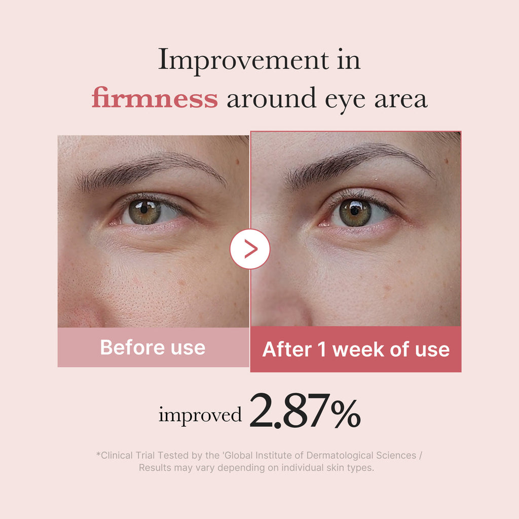 Medicube PDRN Pink Peptide Eye Cream – 30 mL