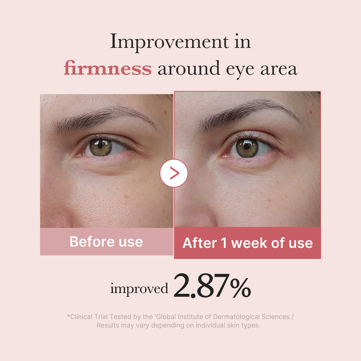 Medicube PDRN Pink Peptide Eye Cream – 30 mL