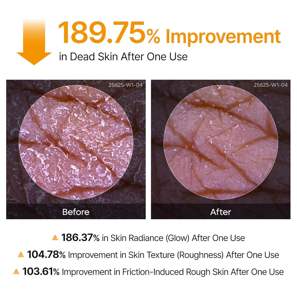 Dr. Melaxin Peel Shot Exfoliating Kojic Acid Turmeric Spray – 200 mL