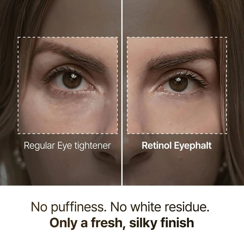 Dr. Melaxin Eyephalt Retinol Eyebag Cream – 10g.