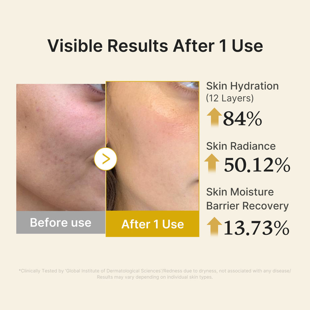 Medicube Kojic Acid Turmeric Vita Jelly Mist Serum – 60ml