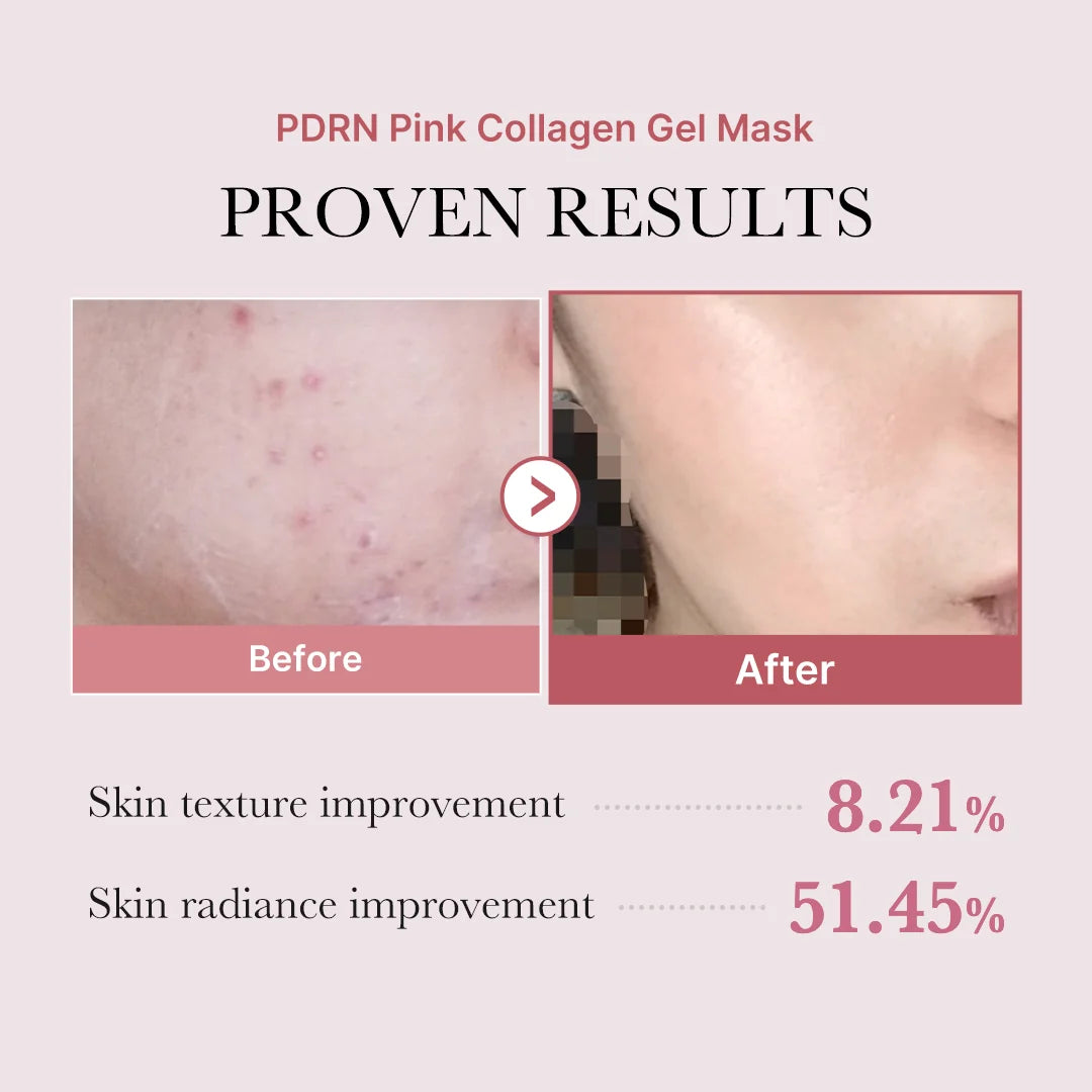 Medicube PDRN Pink Collagen Gel Mask – 4 Pack
